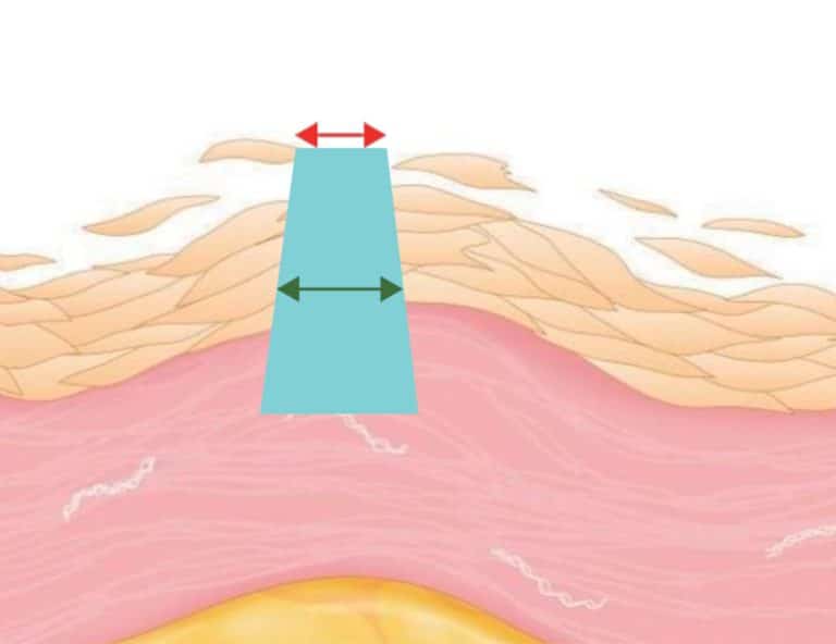 示意圖顯示皮膚結構，強調不同層次的細胞和其在皮膚健康中的作用，適用於皮膚科及護膚產品的推廣。