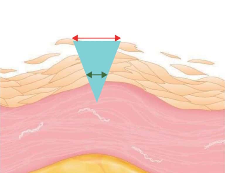 示意圖展示皮膚結構，強調角質層和真皮層之間的關係，並標示皮膚的厚度和細胞層的變化，適用於皮膚護理及美容教育。