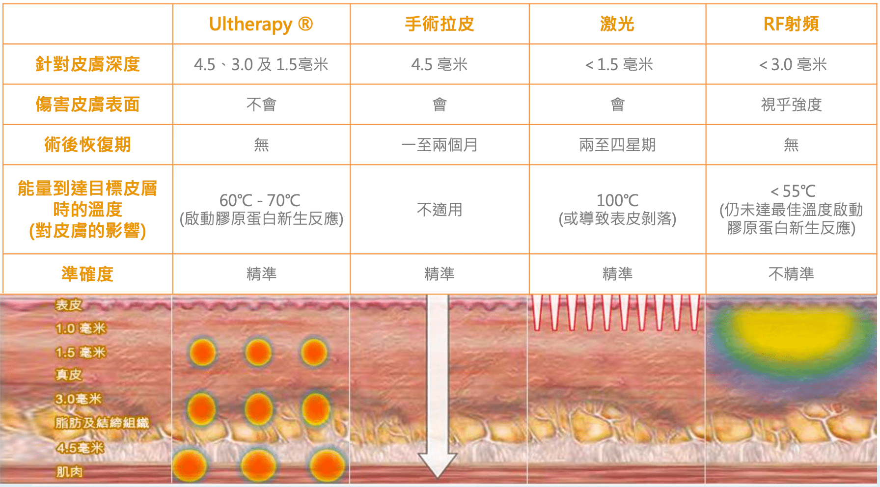 Ultherapy與其他療程的比較表，顯示不同治療方法的深度、溫度和效果，強調Ultherapy的優勢。