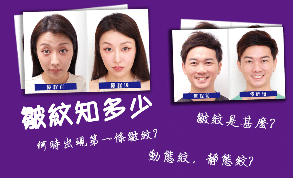 顯示一組前後對比照片，展示接受肉毒桿菌療程前後的面部變化，並附有問題文字如「肉毒知多少」和「肉毒是甚麼？」強調美容注射的效果和常見疑問。